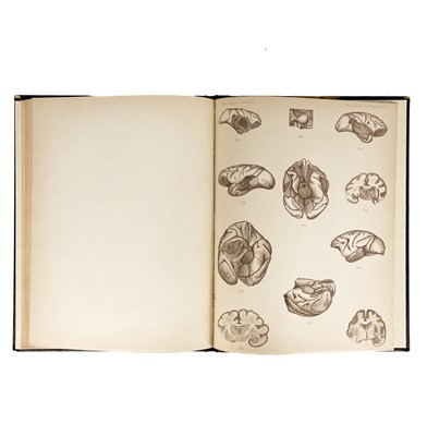 Lot 301 - The Cerebral Cortex and the Motor Cortex. Two works