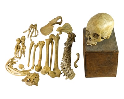 Lot 298 - A Victorian human half skeleton and skull.