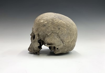 Lot 44 - Human anatomy, adult skull, lower mandible...