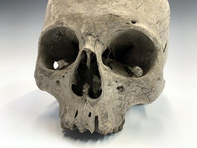 Lot 44 - Human anatomy, adult skull, lower mandible...